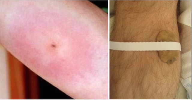 10 Effective Traditional Home Remedies That Our Grandparents Used For Different Ailments